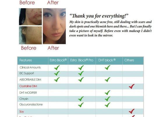 Estro Block and Acne
